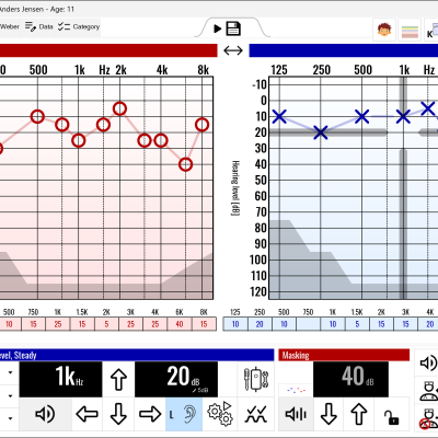 Puretone test